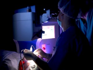 Skidanje dioptrije, Femto LASIK i SUPRACOR metoda