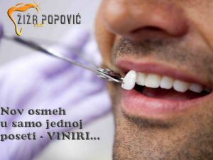 Solo krunice i viniri