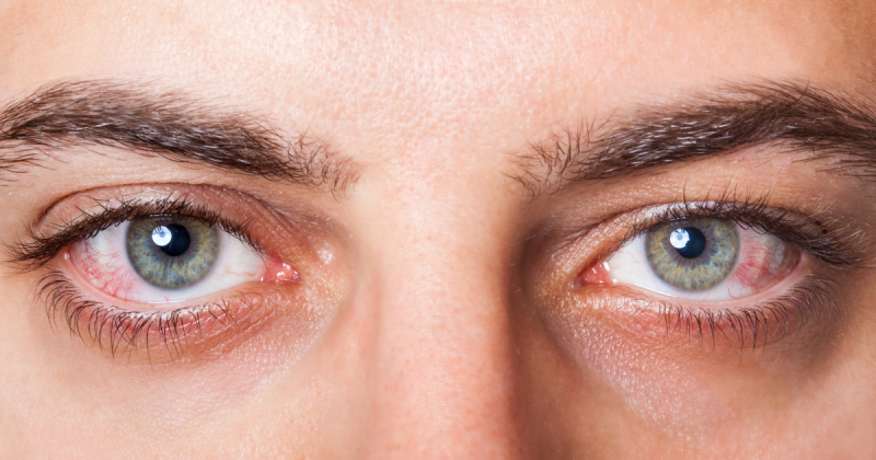 Dijabetesna retinopatija Vidar Orasis Swiss